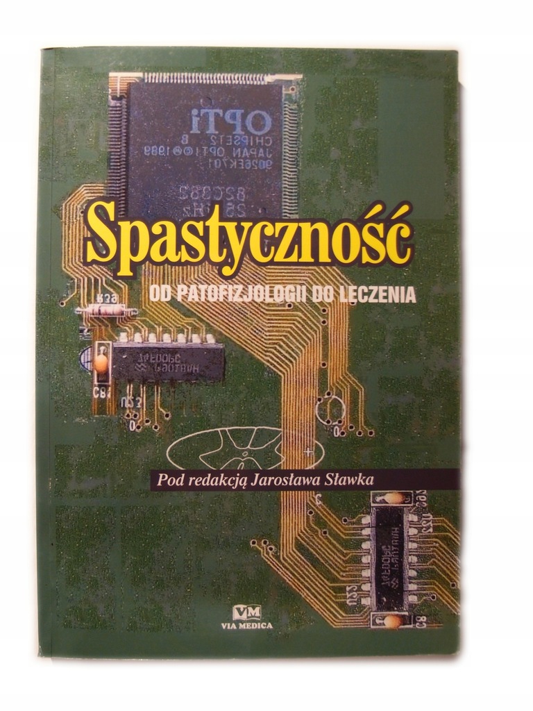 Spastyczność od patofizjologii do leczenia Sławek