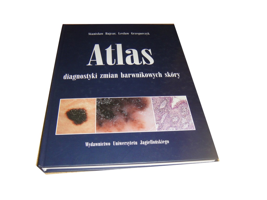 ATLAS diagnostyki zmian barwnikowych skóry Bajcar