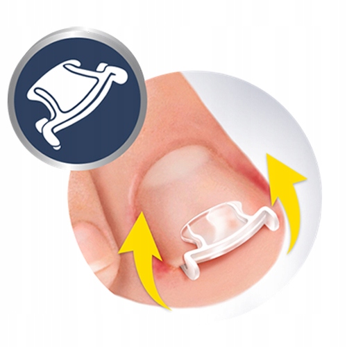 SCHOLL ZESTAW NA WRASTAJĄCE PAZNOKCIE KLAMRY+SPRAY - 7469379506