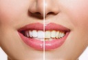 НОВЫЕ полоски для отбеливания зубов Bright White, 14 шт.