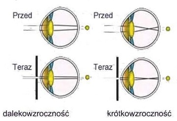 Аюрведические корректирующие оправы EYE HEALING